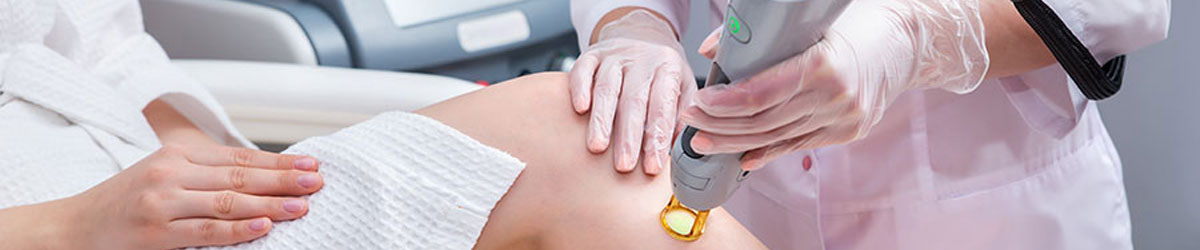 Laser Hair Removal